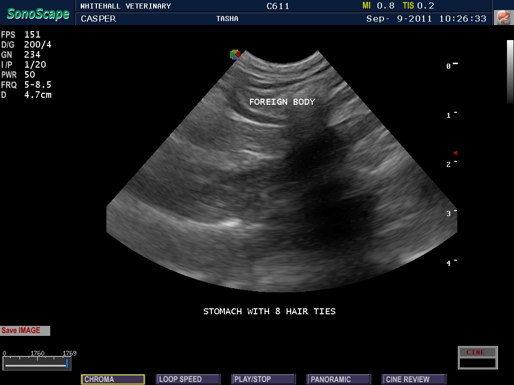 Tasha ultrasound